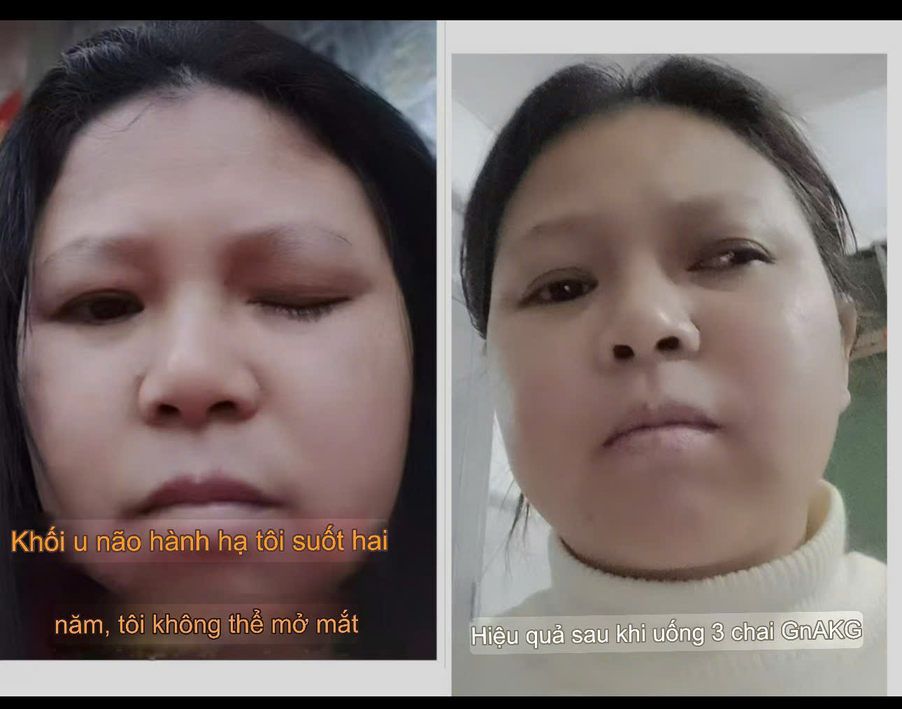 Testimonial ( lời nhận xét ) Chống lão hoá GnAKG  - HIGO global