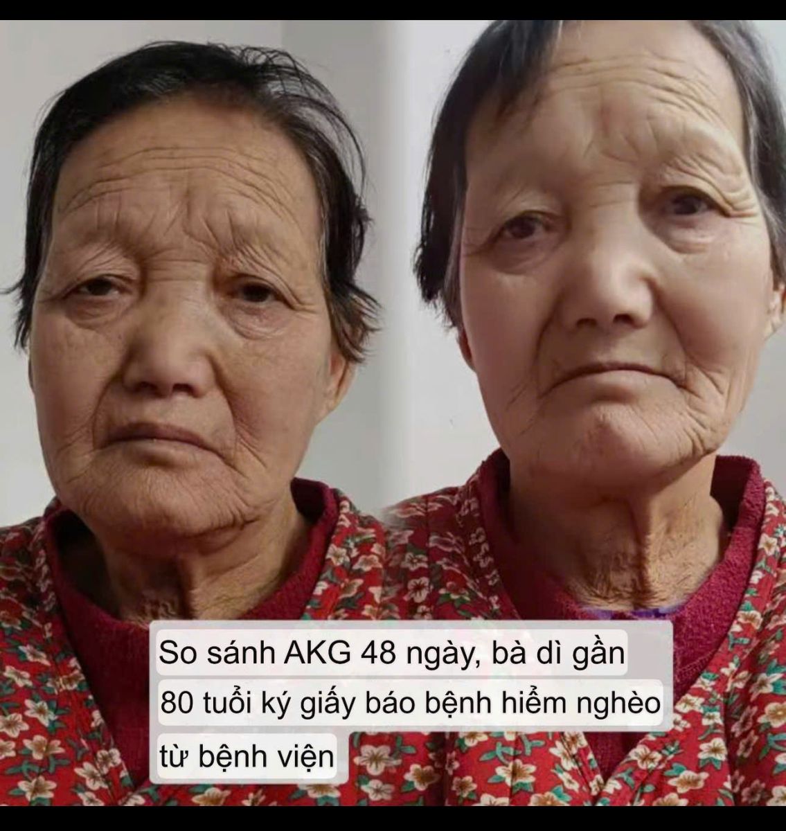 Testimonial ( lời nhận xét ) Chống lão hoá GnAKG  - HIGO global