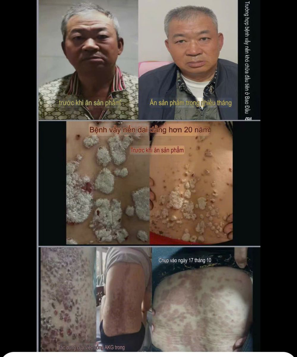 Testimonial ( lời nhận xét ) Chống lão hoá GnAKG  - HIGO global