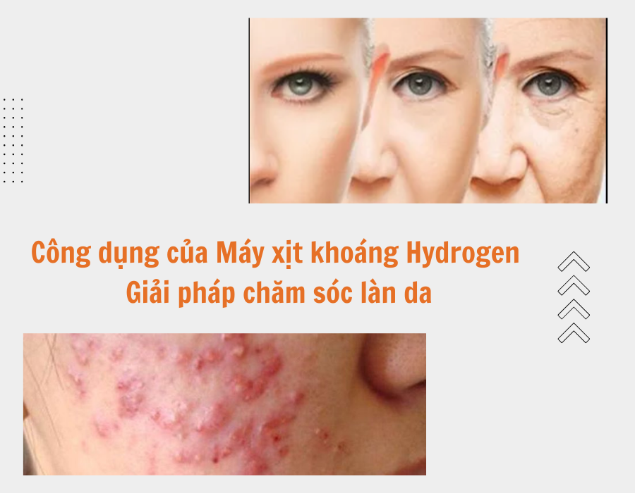 Máy Hydrogen - Chăm sóc làn da - Hydrogen Beauty Sprayer - Prife